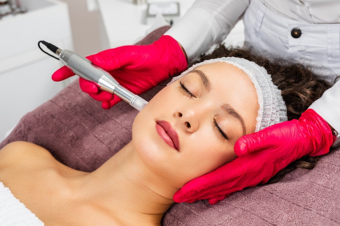 Microneedling Myths Busted: What You Need to Know